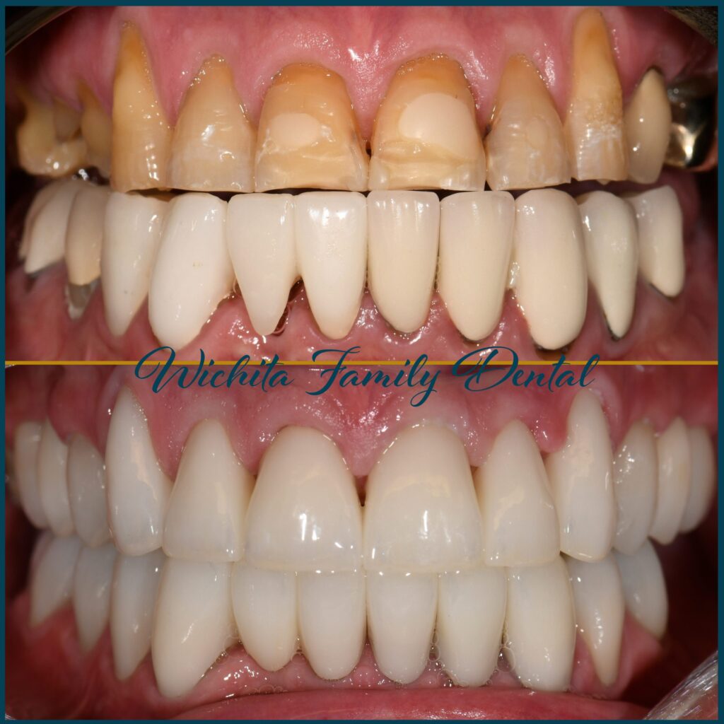 Before and after images at Derby Dental Care depicting improvements in dental appearance and function.